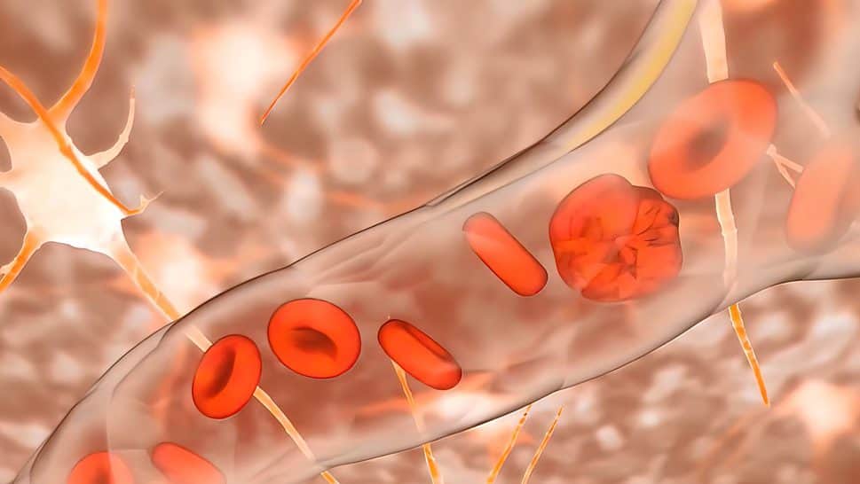 blood clot formation 3D Medical illustration